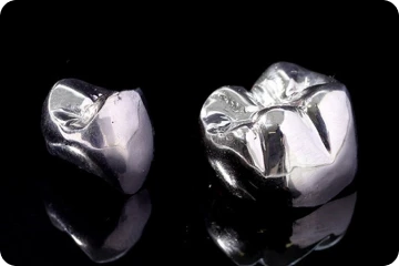 銀合金冠 (奥歯)