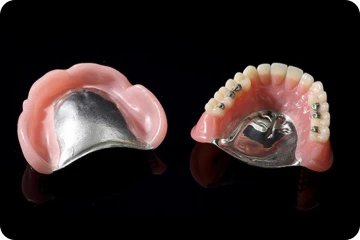 金属床義歯(自費)